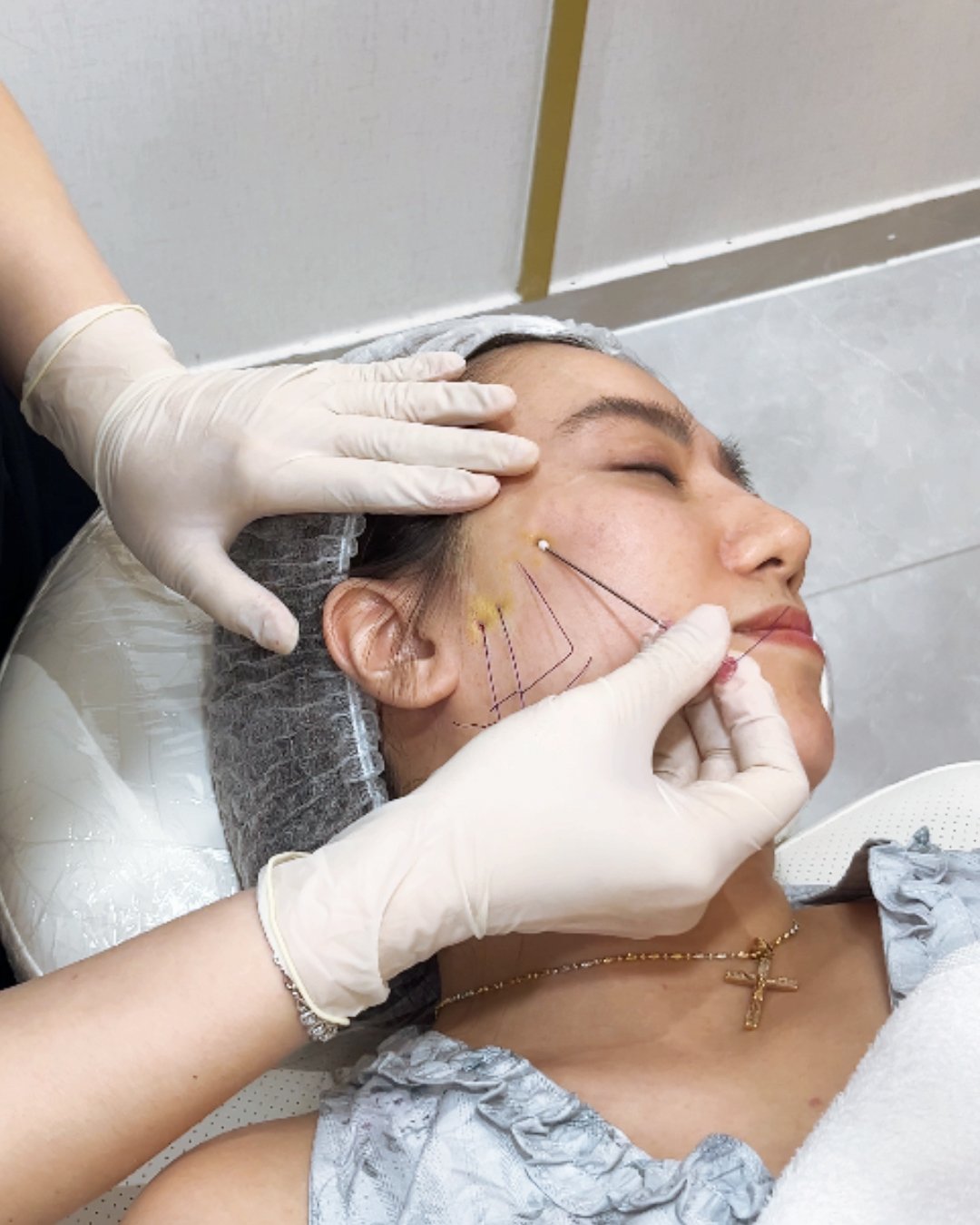 Anti Aging & Contouring