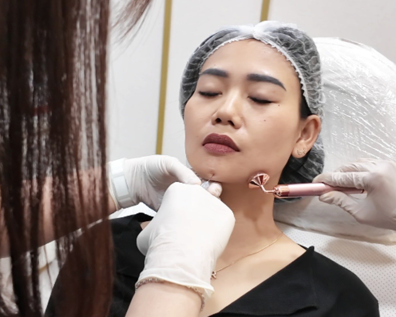 Dermal Filler