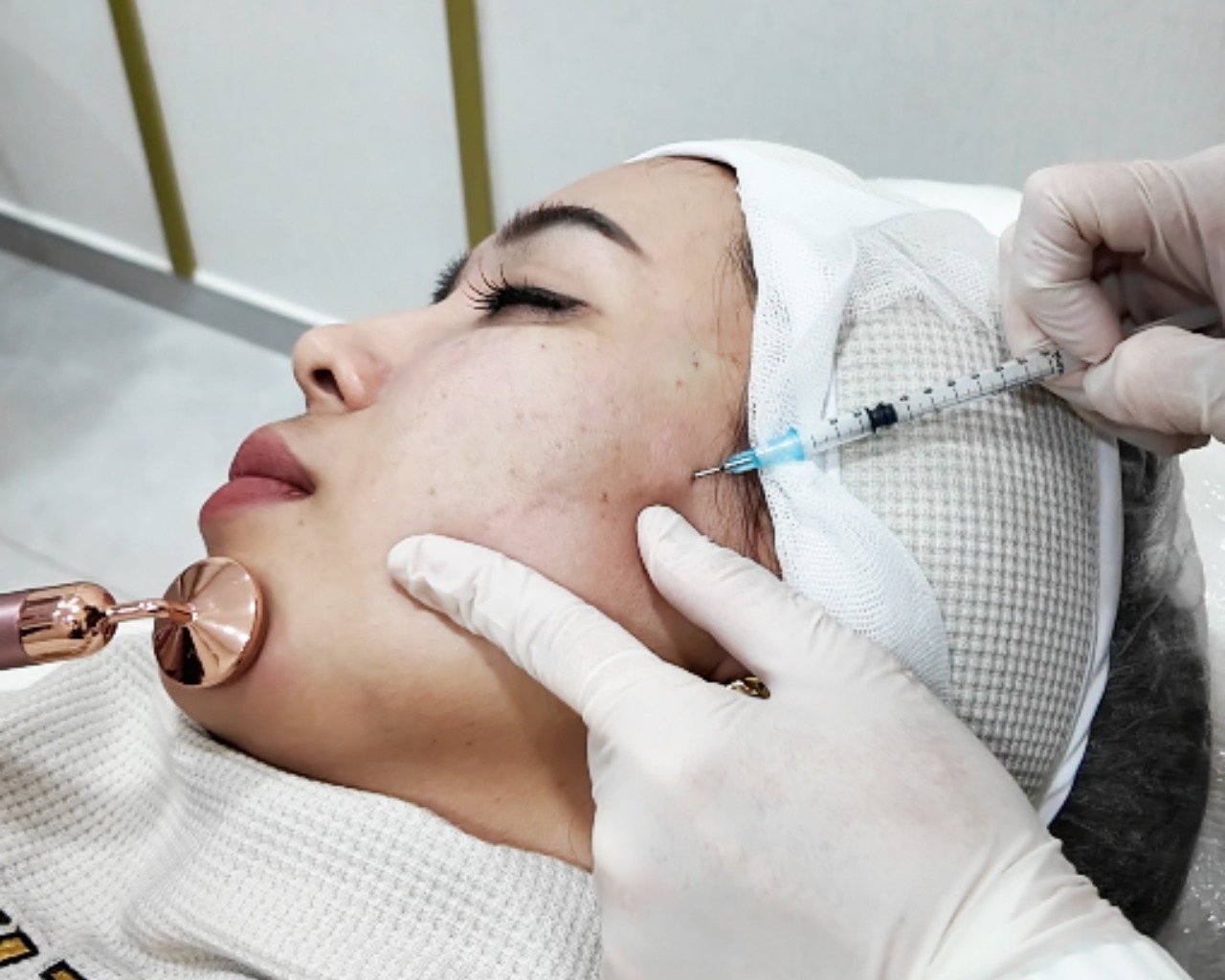 Subcision
