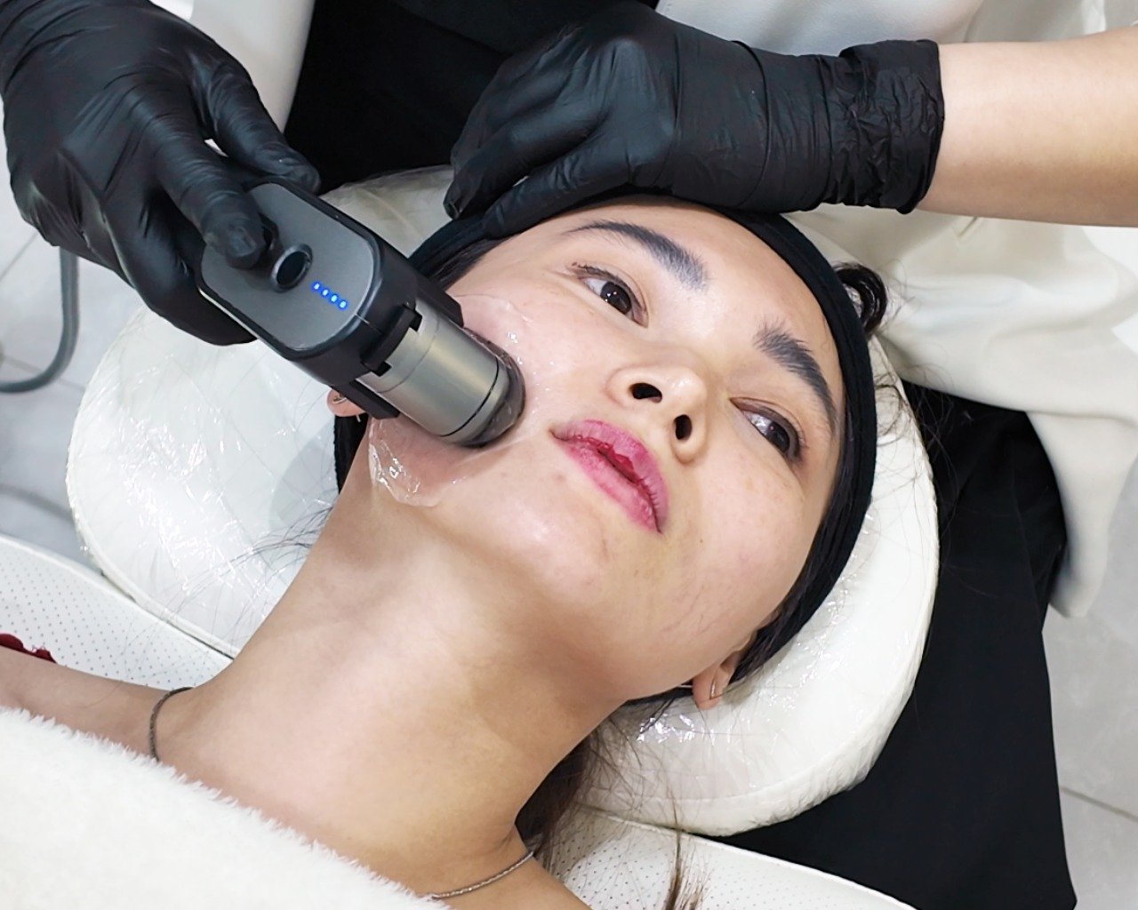Ultra HIFU for Face