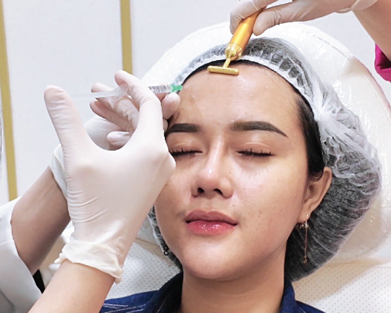 Botox
